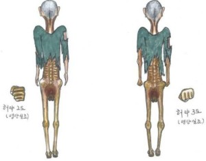 (11)If a vertical knuckle can enter the anus, it means frailty level 2.  If a horizontal knuckle can enter the anus, it means frailty level 3,  which indicates that the detainee will die soon.  A detainee found to be at frailty level 3 is thrown out of the Camp.